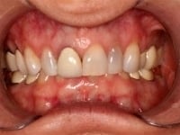 Konig Center for Cosmetic & Comprehensive Dentistry smile photos